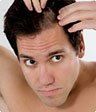 hair loss treatment